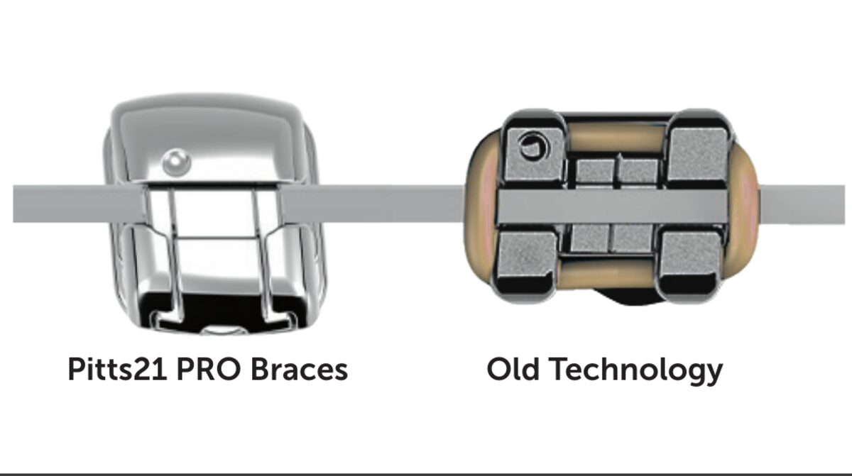 Side-by-side illustration of Pitts21 PRO bracket on the left vs older bracket technology on the right